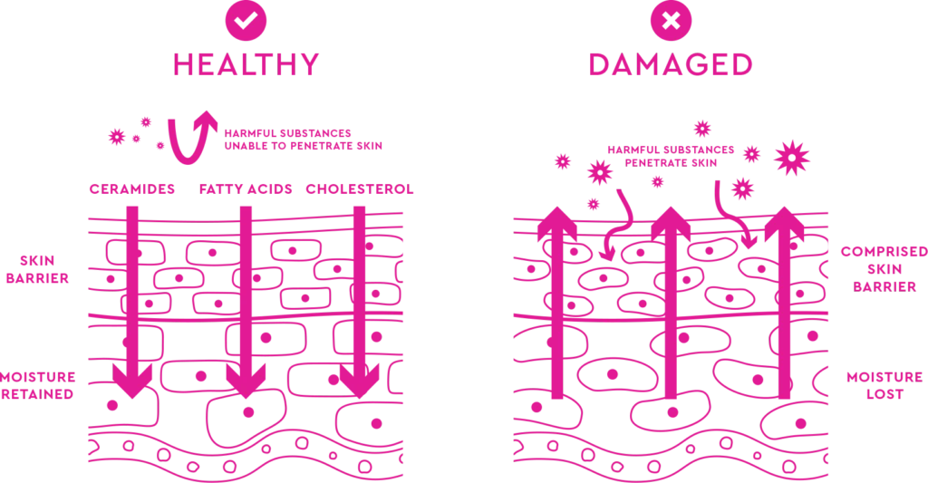 A comparison of healthy vs. damaged skin barriers, highlighting moisture retention and protection vs. moisture loss and vulnerability.